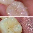 설 치과기공소 이미지