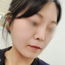바로그의원 | 천안아산 코필러+하이코 추천 바로그의원 후기