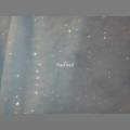 나드네일(NAD nail)