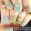 강자안손톱 이미지