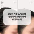 탈모왕 본점 이미지