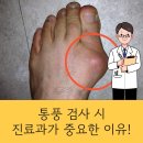 류마이준희내과의원 | 통풍 예방, 손가락에 통증이 생기지 않으려면? [서면 류마이준희내과의원]