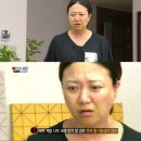 김숙피부