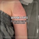 시청로 | 광주 상무지구 신부관리 팔뚝관리 2회차 후기 :: 비브에스테틱