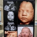 인정병원 | 인정병원 26주 임당 재검 후기😭 검사 결과 + 입체초음파 다음날 재도전