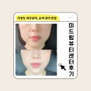 나나약국 | [가양피부관리] 미드림뷰티센터, 알고 보니 윤곽 관리 맛집!