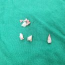 사랑니톡앤턱치과의원 이미지