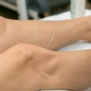 에코한의원 이미지