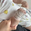[육아일기] 13개월아기 구내염 수족구(이레아이병원 : 피검사, 수액 치료 후기)
