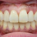 엠웍스 치과기공소 이미지