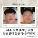 제주 피부관리실 블링뷰티에서 등관리·윤곽관리 받고 온 후기
