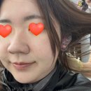 카프리 | 강남역 피부과 카프리 레이저 내돈내산 솔직 후기