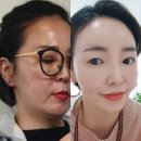인셀덤명품피부샵