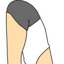 만성 이미지