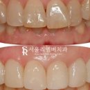 서울리멤버치과의원 이미지