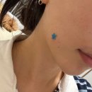 비스팟 | 별모양 여드름패치 추천｜브이비랩 아크네 스팟 케어 패치 솔직후기