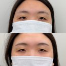 양주옥정눈썹문신 자연눈썹 잘하기로 유명한 리메이드 후기