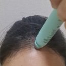 목련헤어라인 이미지