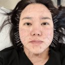 경희건강한의원 | 보람동50대피부탄력 관리, 인위적인 시술 대신 ‘정안침’을 선택하는 이유