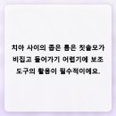 미소지은치과의원 네이버블로그