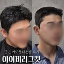 아이비리그컷 직모 밤톨머리 아이롱다운펌 군인 후기