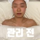 상현동 피부관리, 에스테틱 혜:윰 인센티브관리 받고왔어요