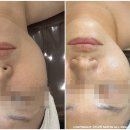 [청주 오송] 프롬더윤 오송점 - 오송윤곽 오송피부관리 맛집 피부까지 빛나는 하이리프팅 리뷰