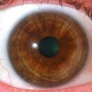 코리아의안센터 이미지