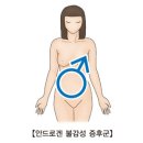 안드로겐 불감성 증후군Androgen insensitivity syndrome(AIS)유전질환 이미지