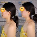 장유농협 관동지점앞 | 김해 에스테틱 추천 미선에스테틱 걸그룹관리 JH 윤곽술1회차 효과 후기