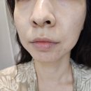 엠바이오랩 주식회사 | 창원 상남동 피부관리 에스테틱 여드름 트러블 르네아 바이더랩 세멘시트 초음파 관리 후기