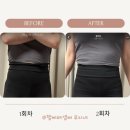 (주)팻라인 | 이오팻으로 뱃살빼기 청담 피부과 바디라인관리 지방분해주사