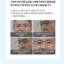 에실로 안경 이미지