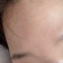 뷰티디바이스 쿼드쎄라 펜타 솔직 후기 | 피부과 대신 찾게 된 얼굴마사지기 홈케어 루틴