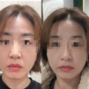 더마블랑 에스테틱