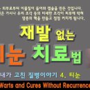 티눈, 재발 없이 치료하는 방법 이미지
