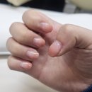 터치바디 | 터치앤바디 부평손톱바디교정후기