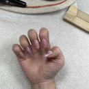 요온네일 이미지