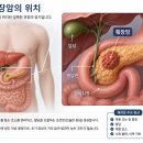 출산 경험 93만명 여성췌장암 위험 최대 30% 낯춘다 이미지