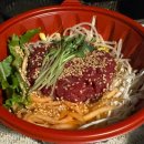 멍 | 허벅지 지방추출주사 일주일 후기 : 멍 통증 붓기