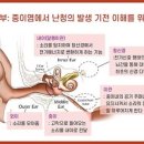 의대보청기 이미지