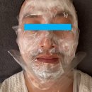 살롱드닥터튠즈의원 | 압구정 피부과 방문기)살롱드닥터튠즈의원 청담본점_울쎄라 시술후기_인생피부과