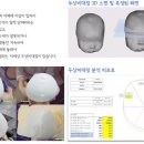 두상비대칭아가 무료검사(3D검사) 이미지