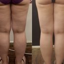 채움테라피 네이버블로그