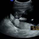 신   풍 | 임신 16주 셀프 젠더리빌 파티 풍 이벤트 준비과정 가격 후기