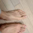 운동 중 엄지 발가락 부상으로 당산역 정형외과 박상준 의원에서 치료받은 후기