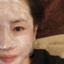 생기한의원스킨케어 | 강남피부관리 명옥헌한의원 엑소좀 MTS 패키지로 40대 얇은 피부 속건조 탈출하기