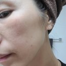 지성메디텍 | 30대 후반 리프팅, 피부탄력 잡는 홈케어 by 듀얼소닉 뷰티 디바이스