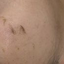 서면 | 인생첫 스킨플래닝 관리 솔직후기 서면 지원네일앤뷰티