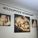 뉴욕스크린골프 | 임신 14주차 뉴욕 한인타운에서 사설 초음파본 후기, 임신 후 골프 및 로드트립